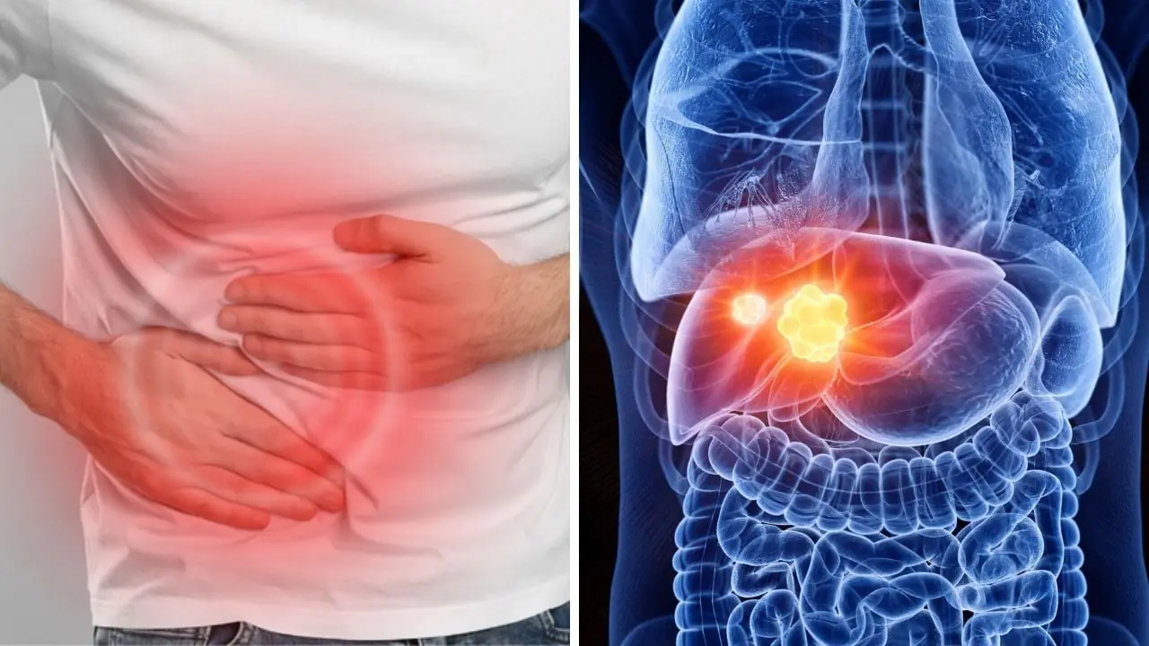 “2 Pains – 1 Yellow”: A Warning Sign Liv.er Can.cer May Be Silently Developing