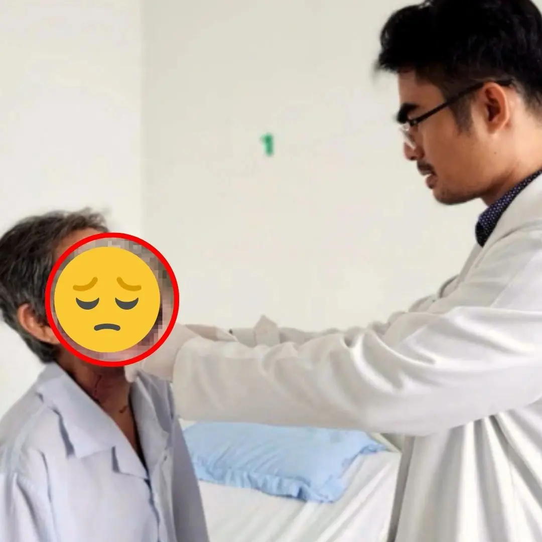 He Ignored the Signs, Thinking It Was a Ca.n.ker Sor.e—Now His T.o.n.gue Is Gone!