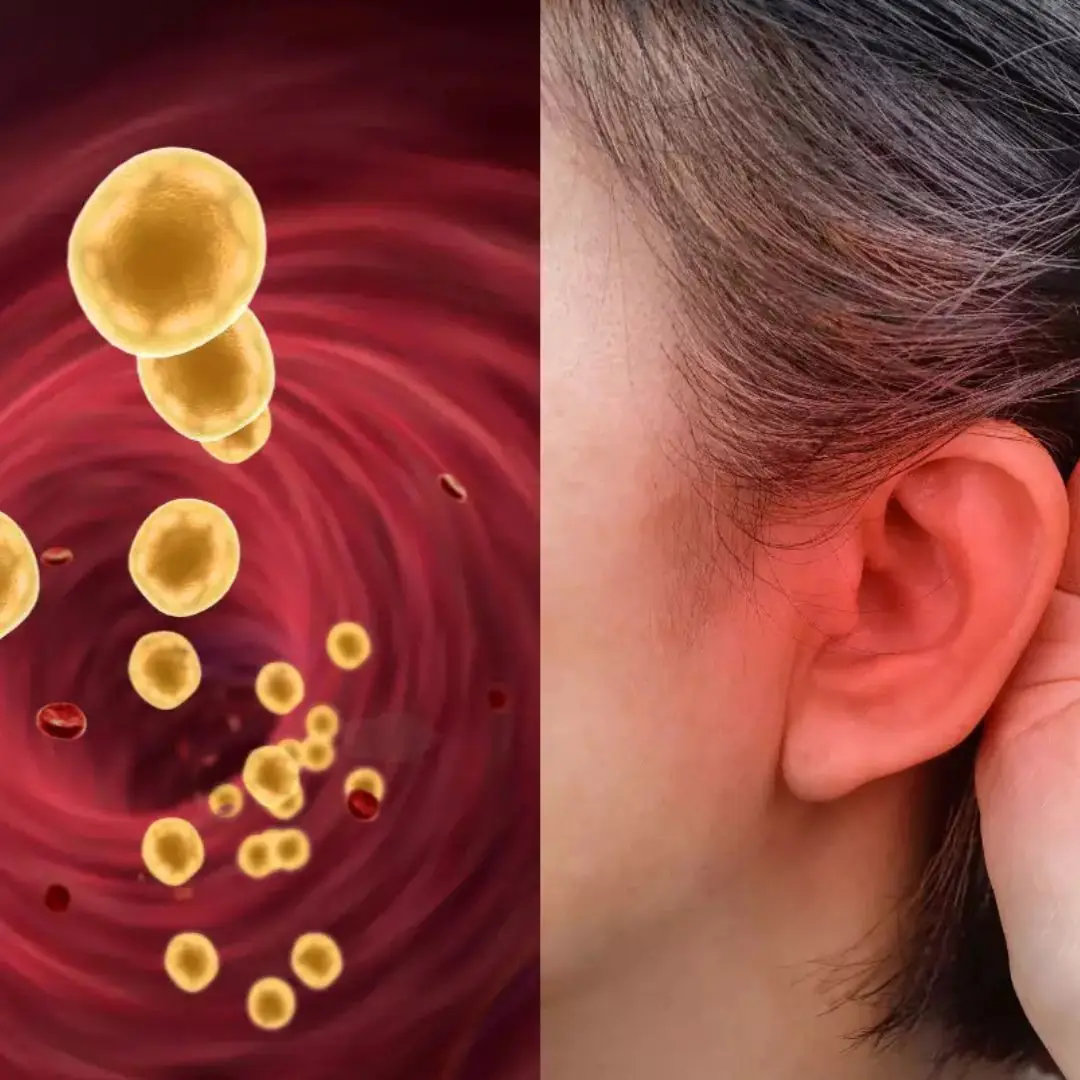 4 signs on the body to detect high bl.o.o.d f.a.t
