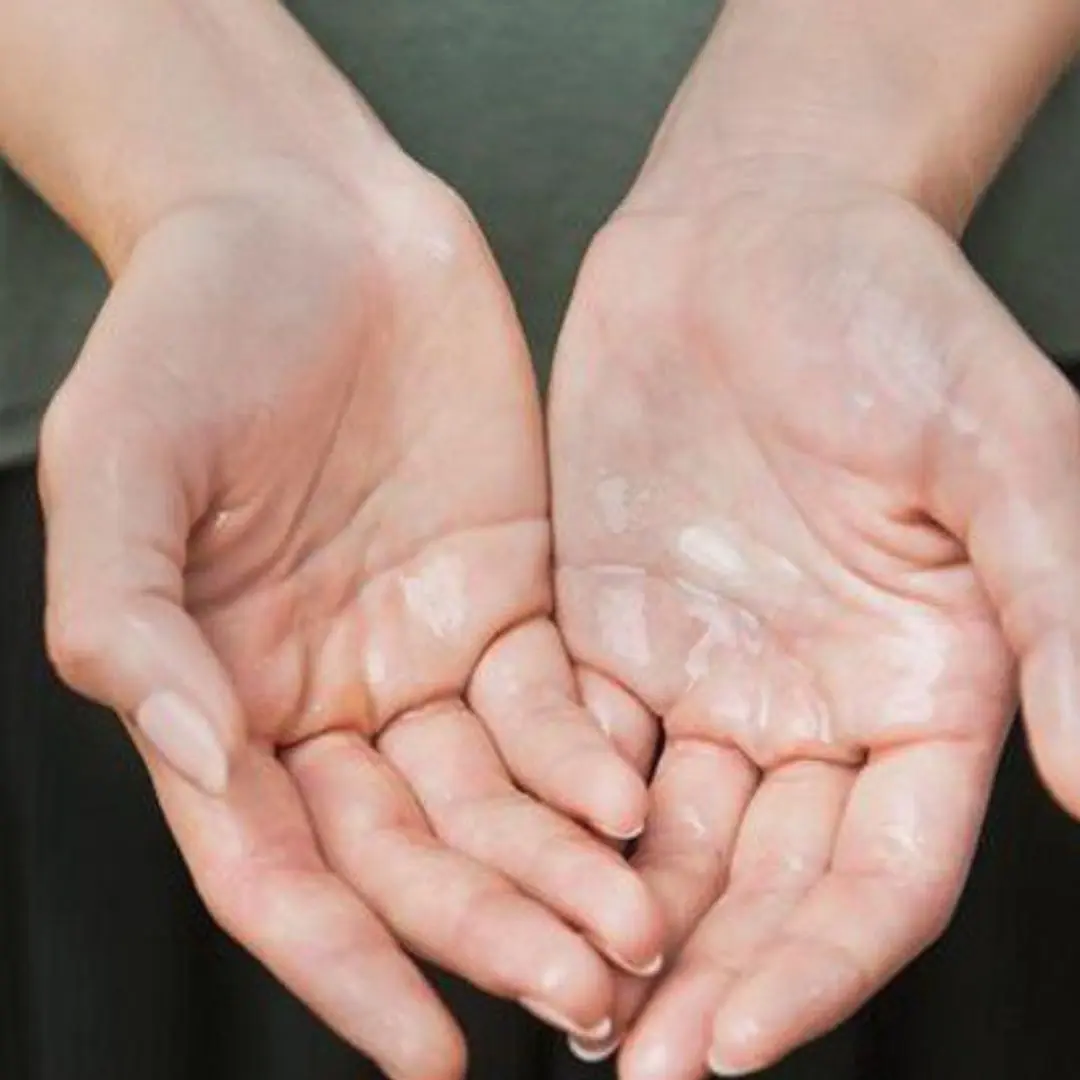 Why do hands and feet sweat in winter?