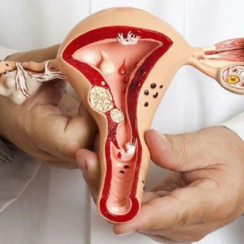 5 earliest signs of cer.vical can.cer: 90% of women tend to ignore them