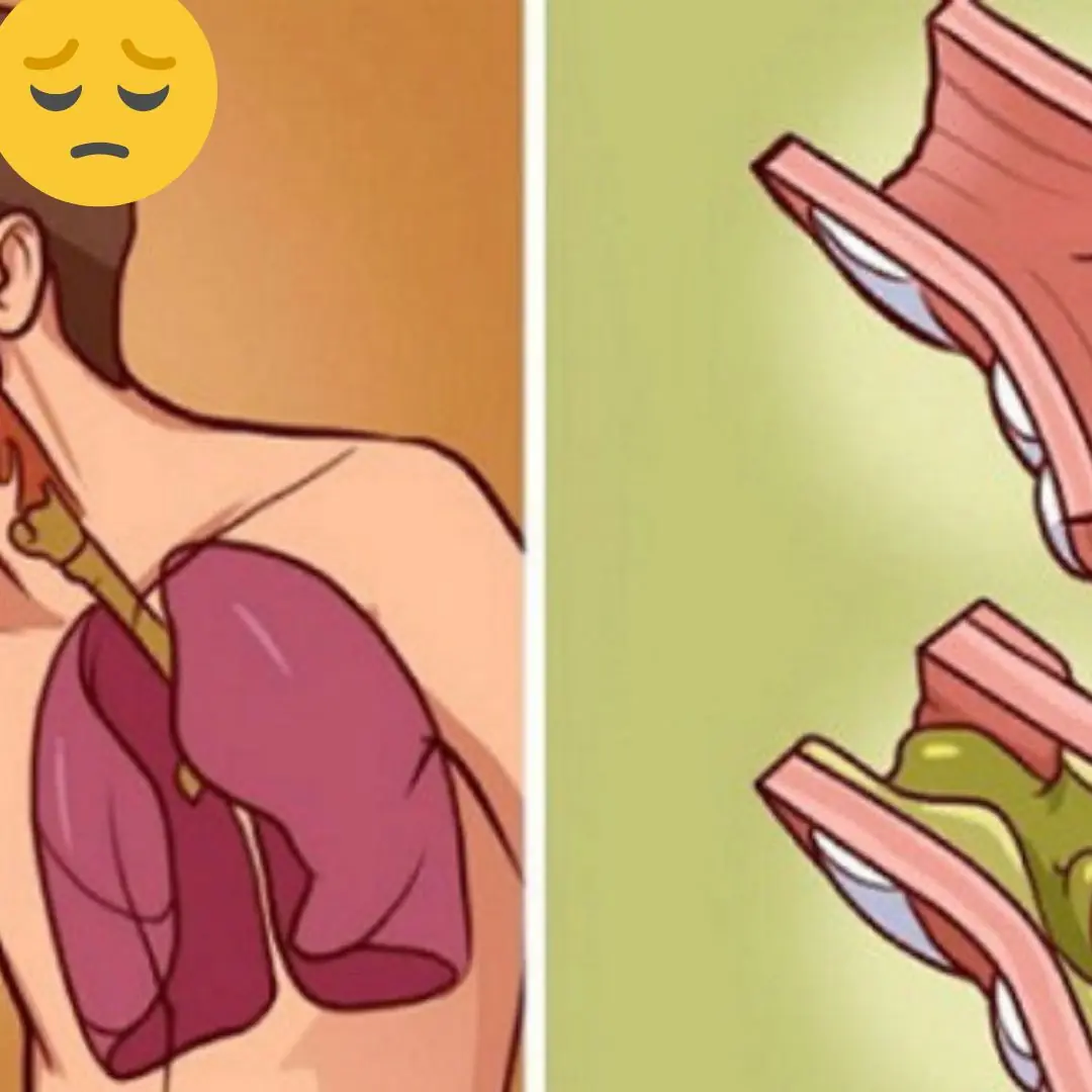 How to remove phlegm and mucus from chest and throat