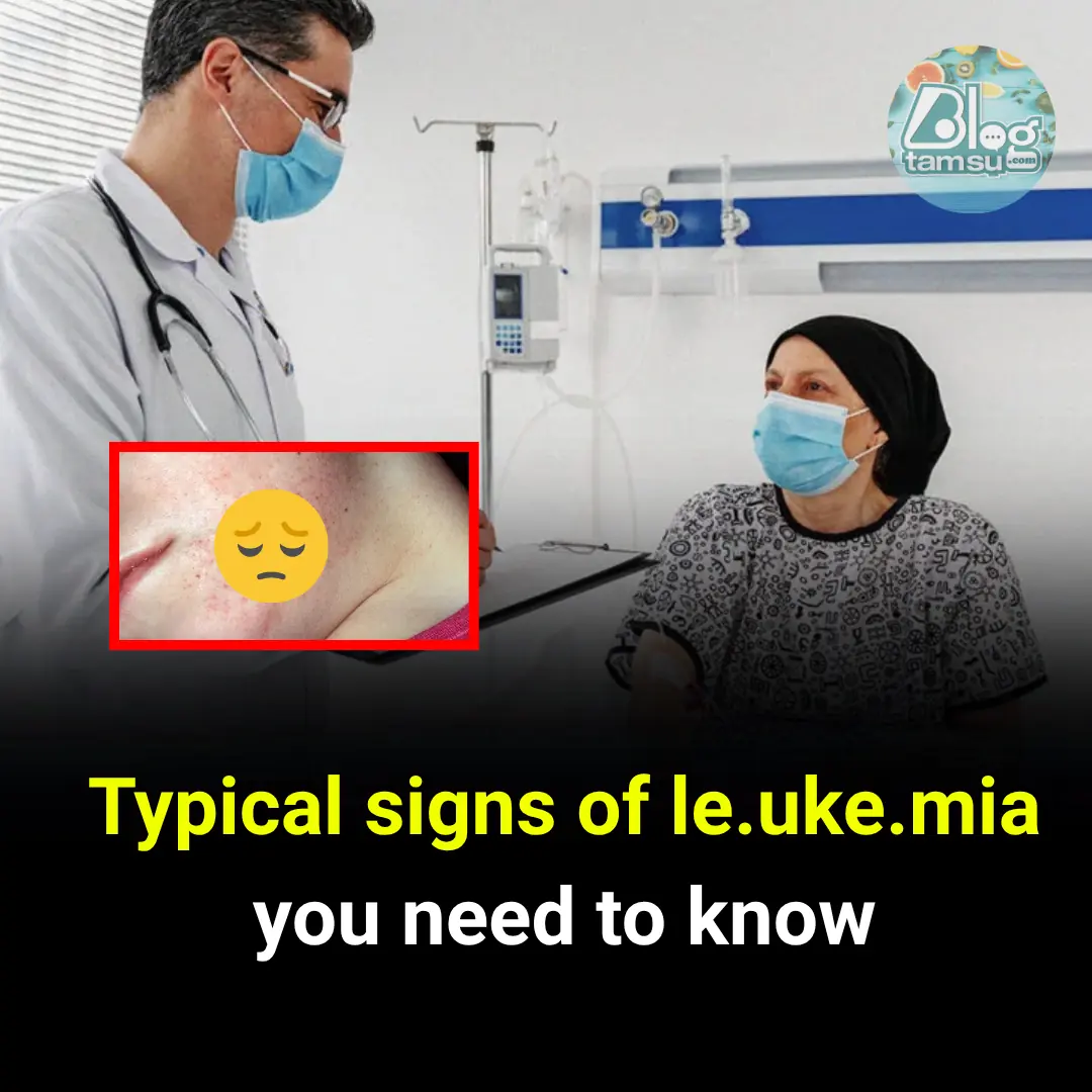 Spot These Early Signs of Leukemia Before It’s Too Late