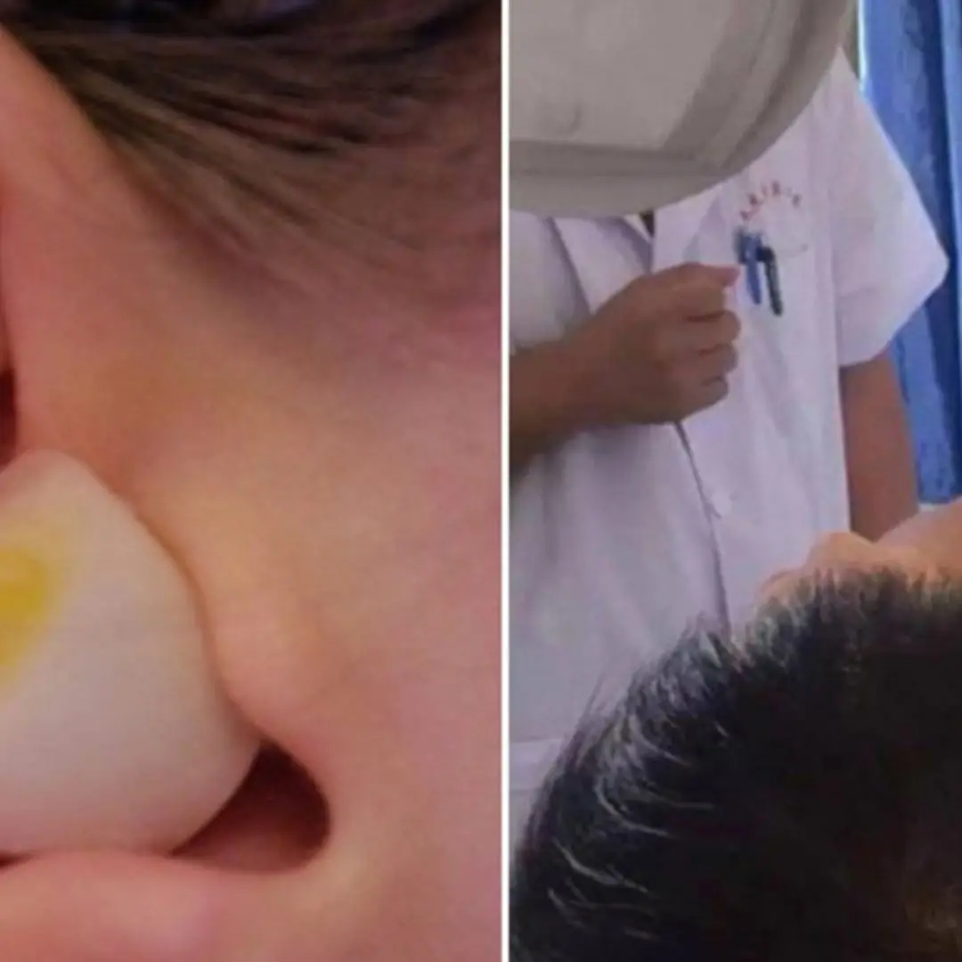 Treating earache with garlic according to folk remedies, the man lost more sleep and received an unexpected ending