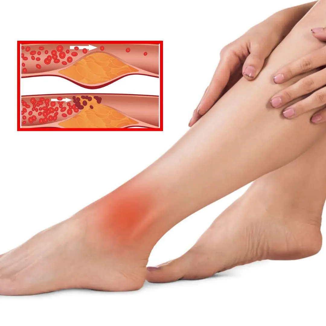 3 characteristics of the feet warn of blocked blood vessels