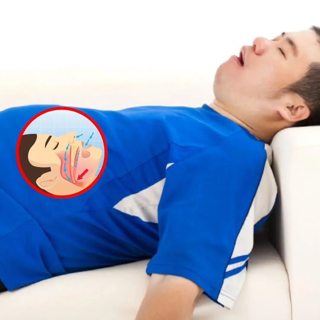 Snoring and 5 Surprising Indicators of Obstructive Sleep Apnea
