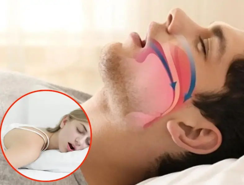 Check out these 6 health conditions when you drool while sleeping