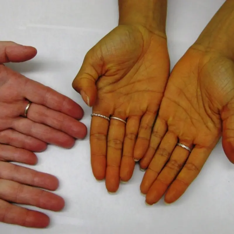 These Are the 5 Earliest Warning Signs Your Body Sends When Can.cer