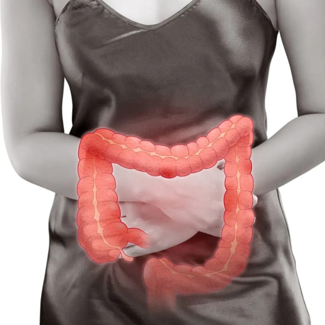 7 foods to avoid in a colon cancer diet