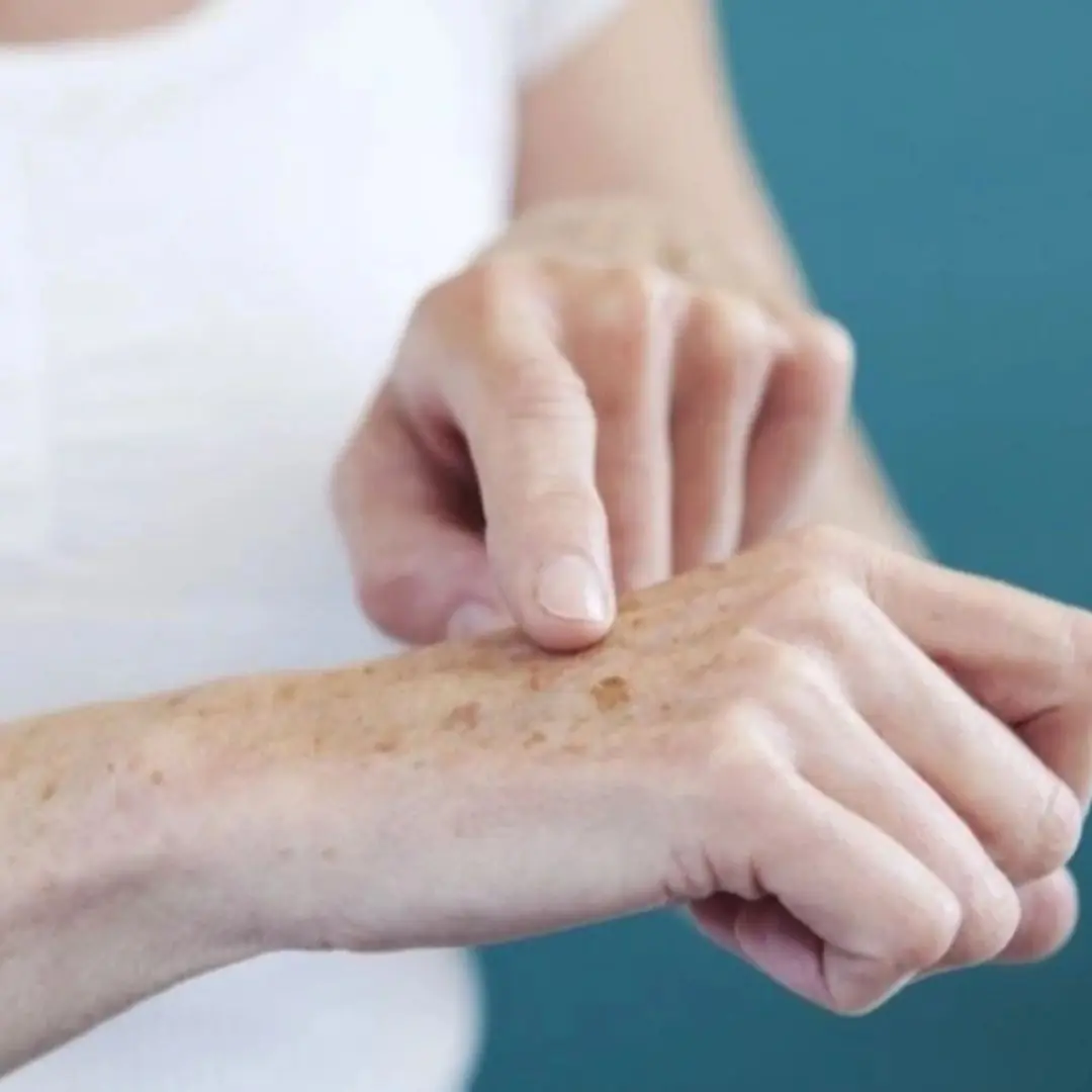 Your hands can warn you: 5 back-of-hand signs linked to health issues