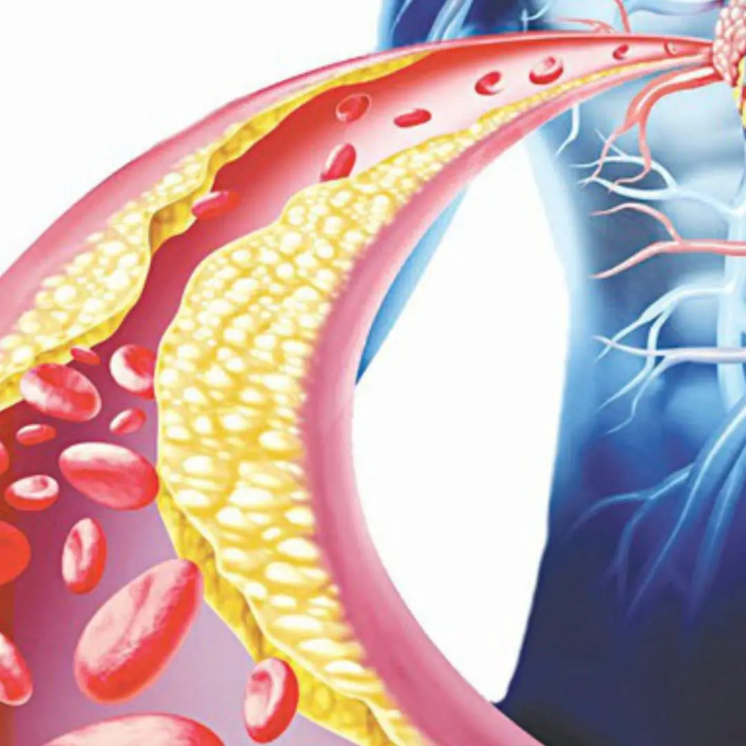3 reasons why the elderly are susceptible to high bl.o.o.d fat and how to fix it