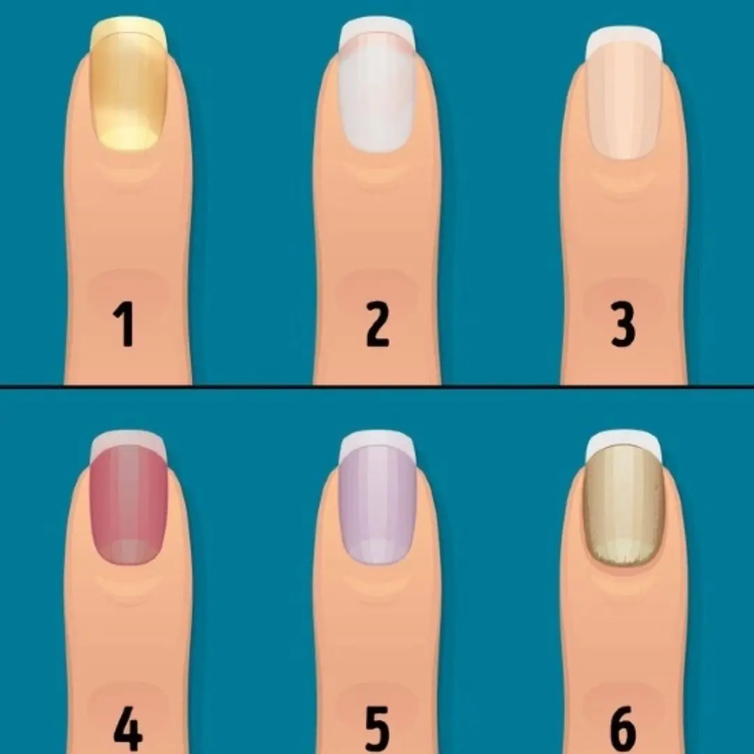 Don't miss: this nail color may be related to heart and lung disease