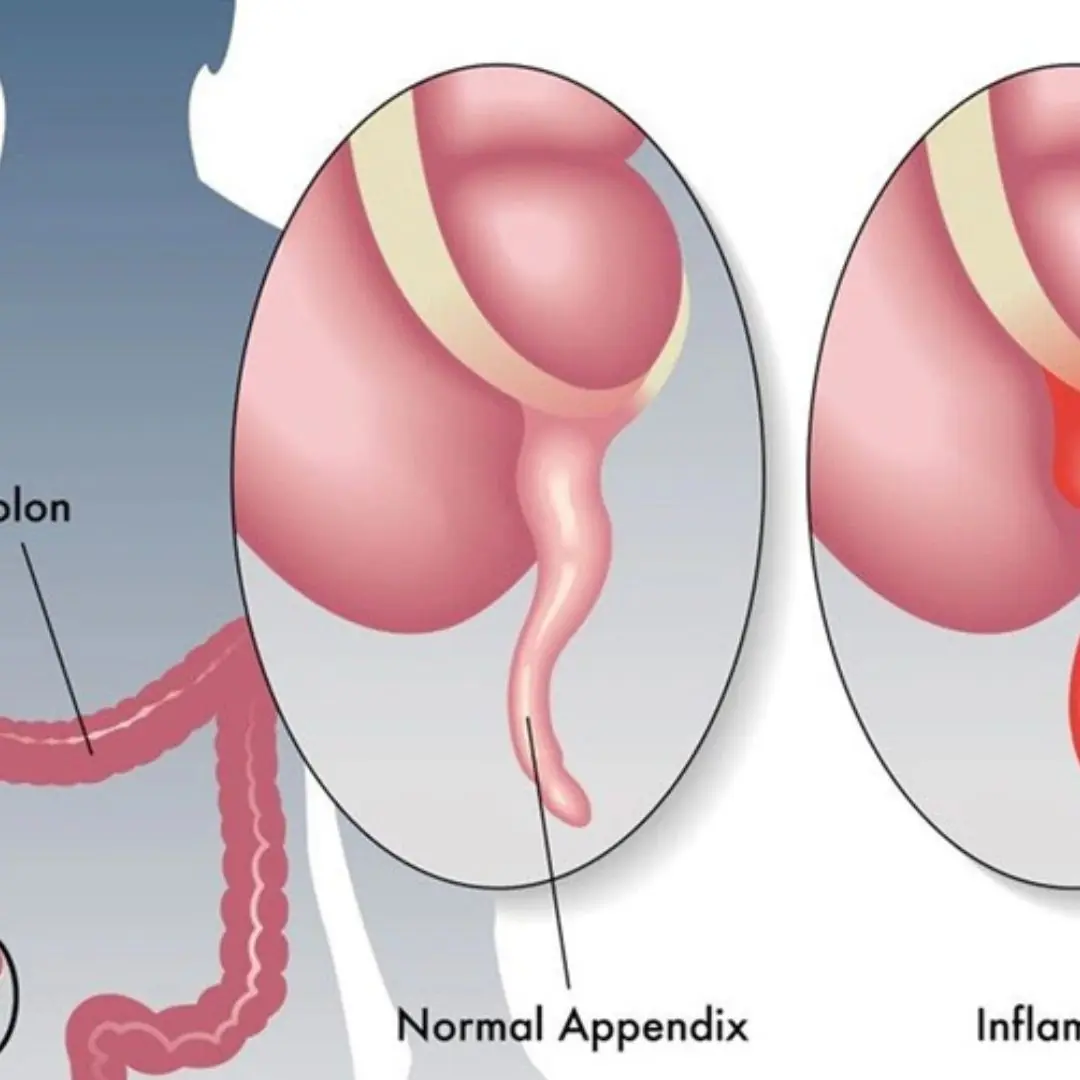 11 most common symptoms and signs as well as effective disease prevention measures