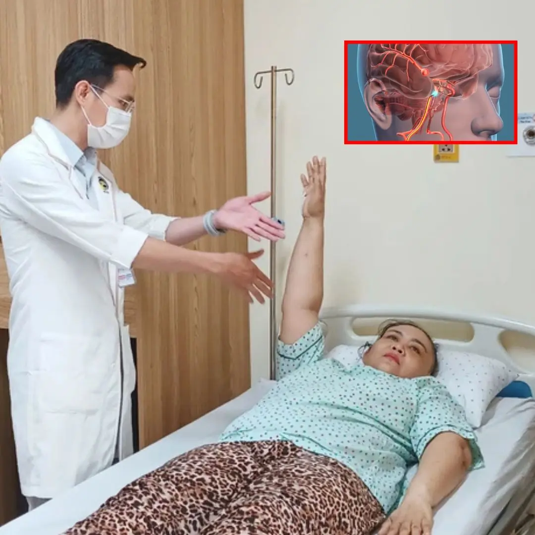 Sudden headache while sweeping the floor, 48-year-old woman went to the doctor and discovered a ruptured brain aneurysm