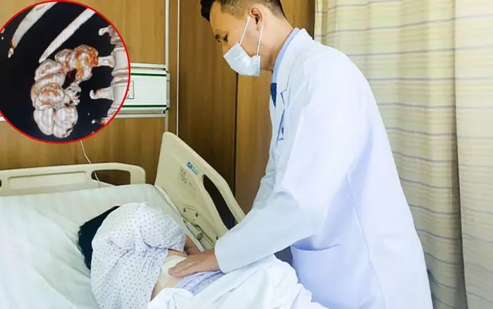 A Woman’s Kid.ney Turned to “Stone” and Had to Be Completely Removed