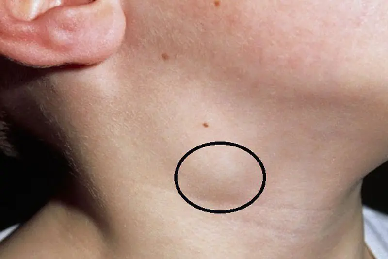 Revealing 6 Obvious Can.cer Warning Signs You Can Spot Just by Looking in the Mirror!