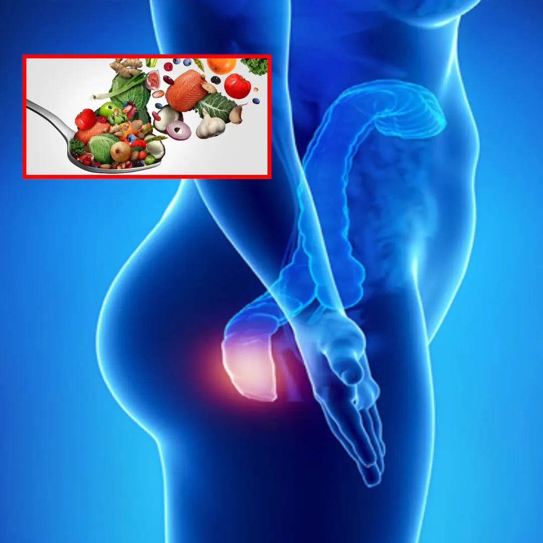 15 Foods That Are Good for People with Hemorrhoids