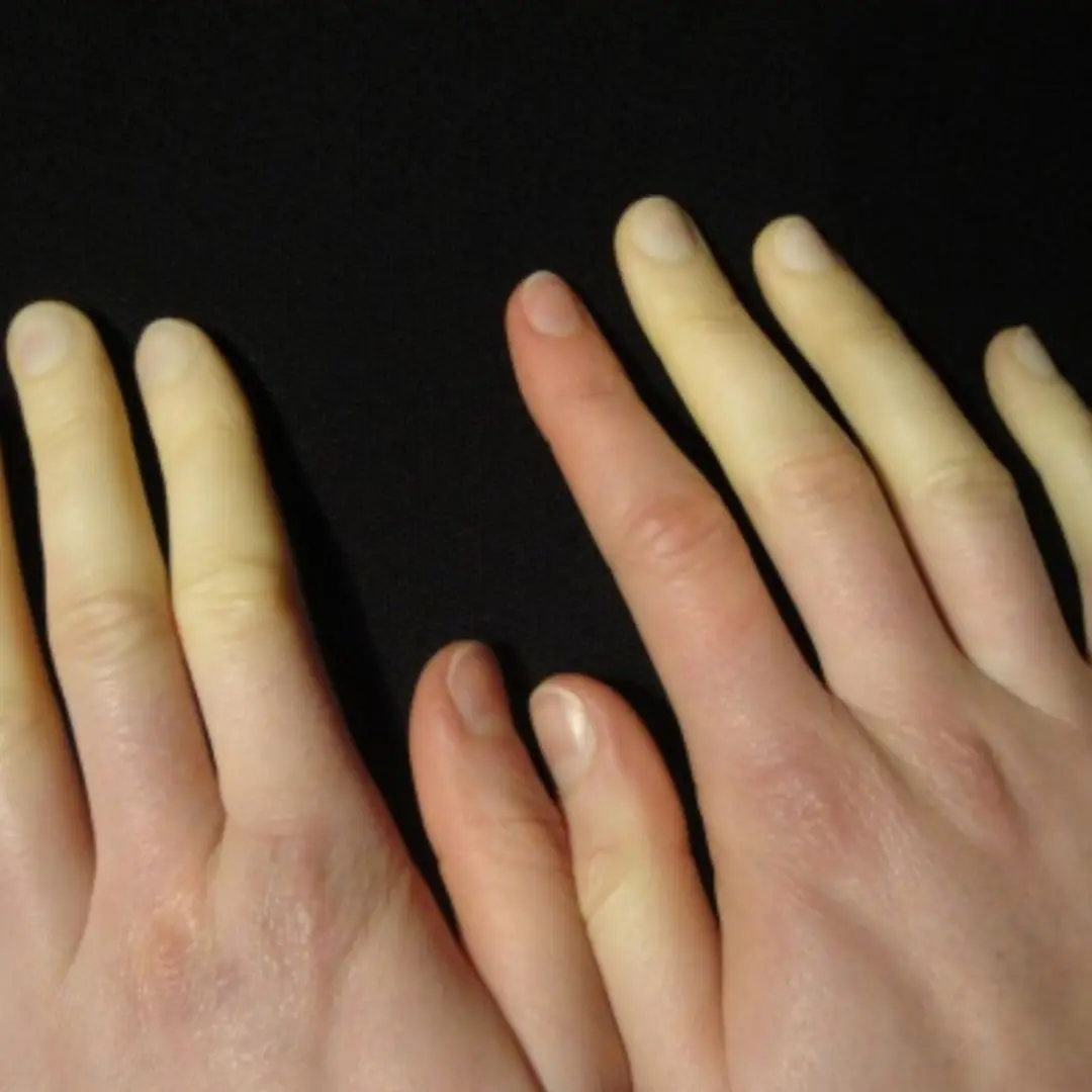 Spot these 10 symptoms? It’s time to see a doctor without delay!