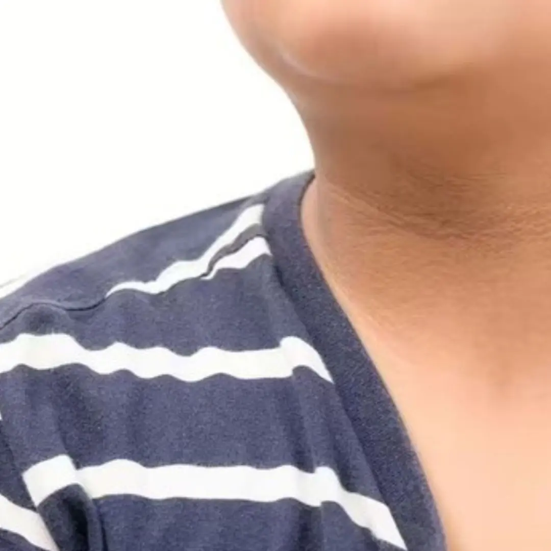 Diabetes can 'show' strange signs in the neck: If you see them, don't ignore them