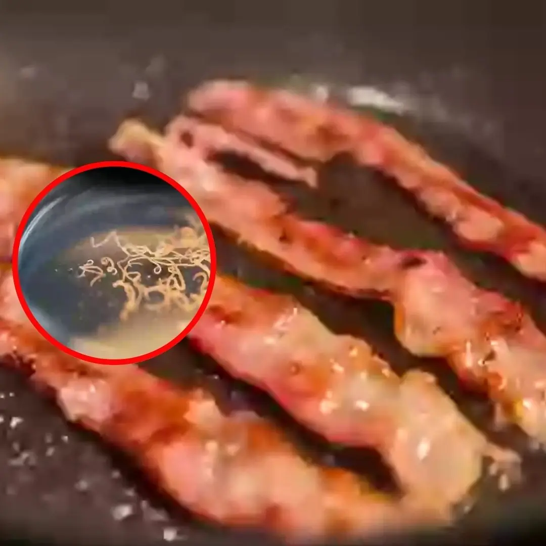 Man develops 'pork worms' in his br.ai.n after years doing this specific cooking habit