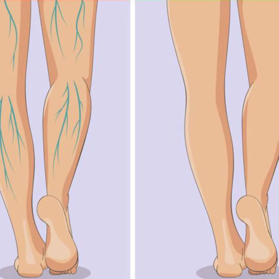 Your Feet Could Be Revealing Serious Health Issues — Watch Out for These 6 Signs
