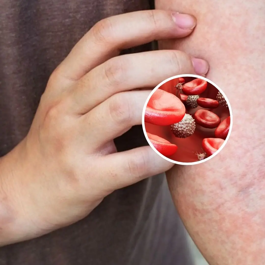 Warning: 10 Overlooked Symptoms That Could Signal Blood Cancer