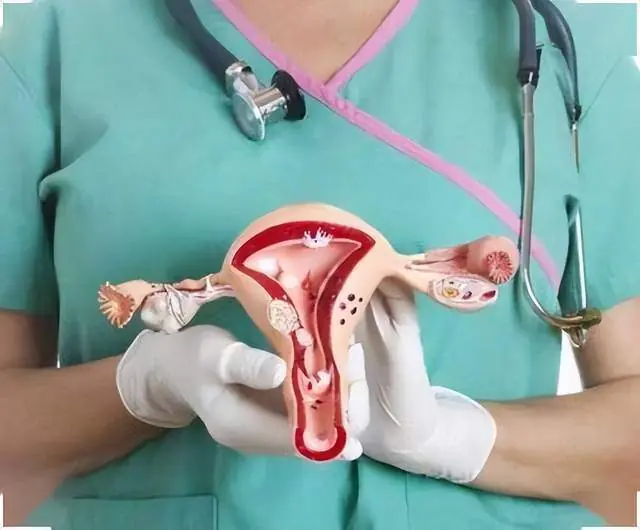 70% of Ova.rian Can.cer Cases Are Diagnosed at a Late Stage