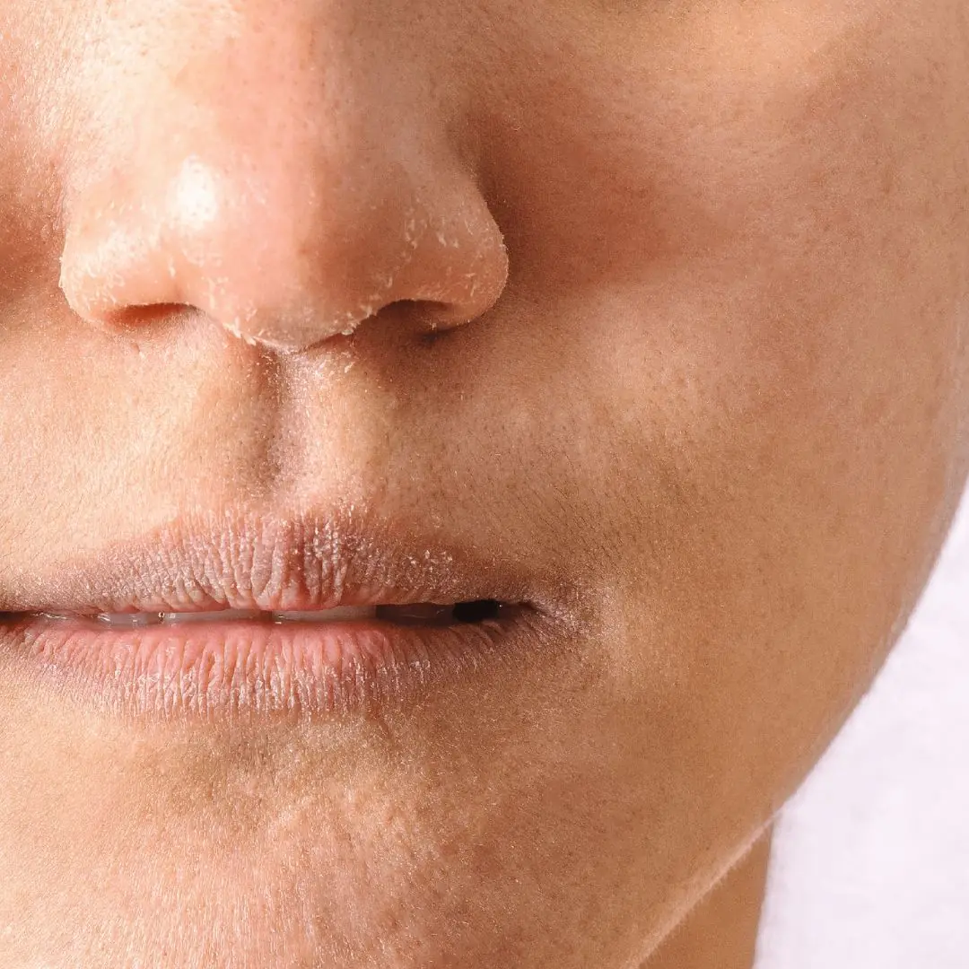 People with healthy kidneys will not have these 3 signs on their skin: If you don't have all of them, congratulations!