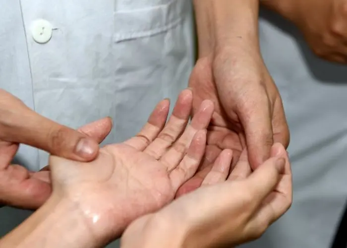 4 types of sweating that can be the body's "cry for help"