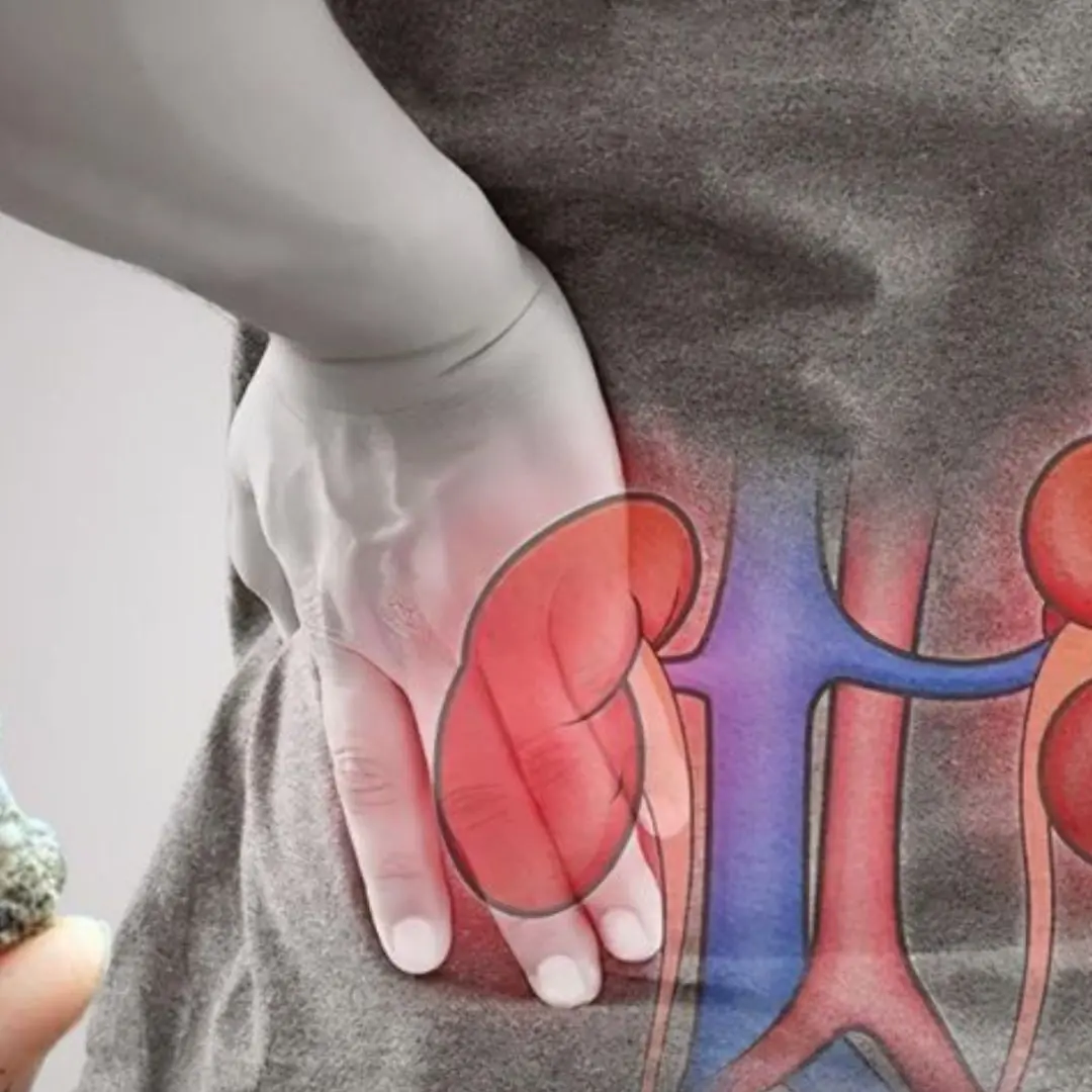 5 Silent Habits That Put Your Kidney Health at R.i.s.k