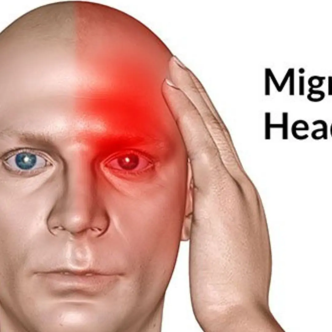War:ning: Frequent recurring posterior migraines may be a sign of a medical condition