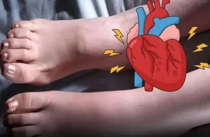 6 Foot Symptoms That May Warn of a Heart Attack Weeks in Advance