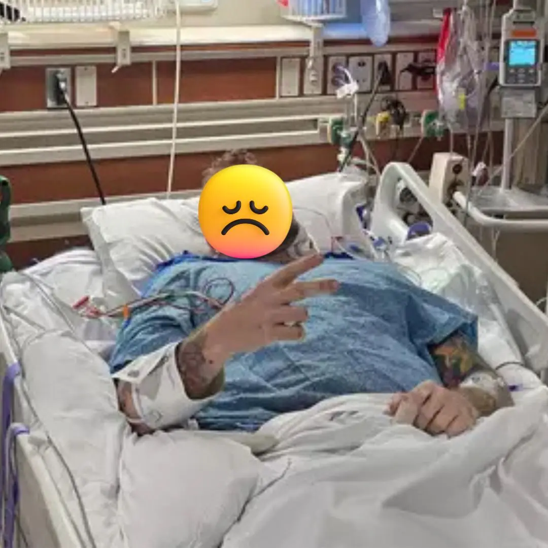 He thought it was just a bu.rnt thu.mb, but woke up to the devastating reality of los.ing both legs
