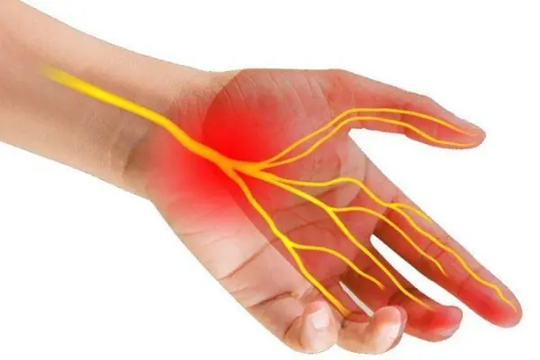Why Are My Hands Numb When I Wake Up and How Can I Treat This?