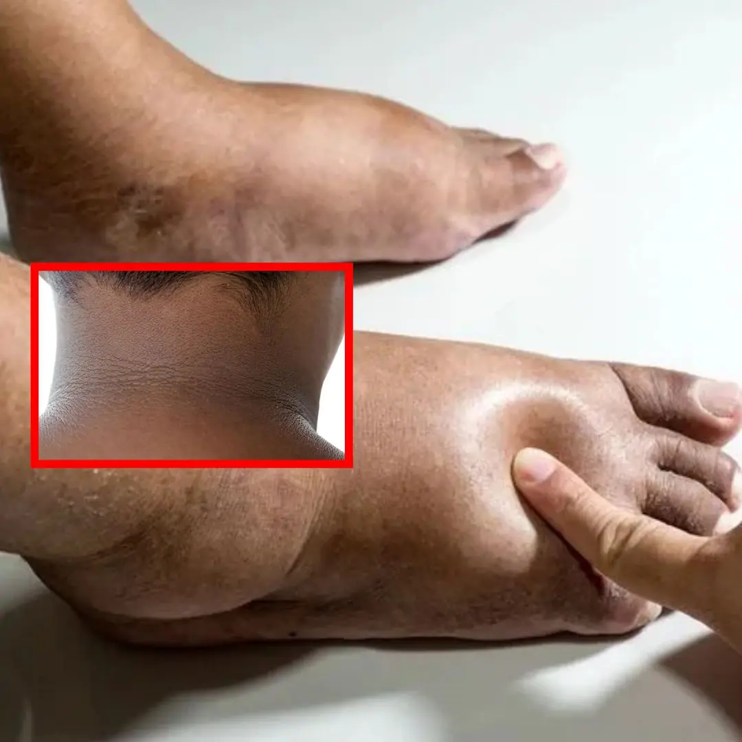 The 5 Main Warning Signs of Diabetic Neuropathy, According to Specialists