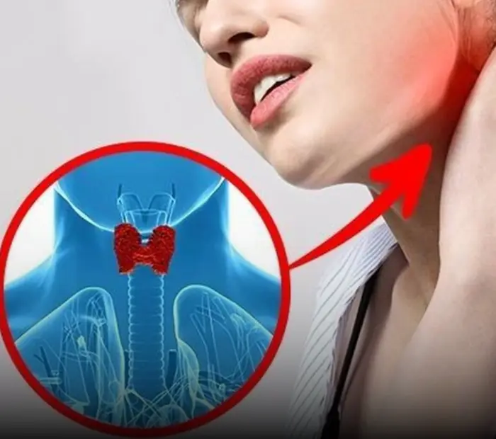 Three warning signs in the neck that could signal early can.cer