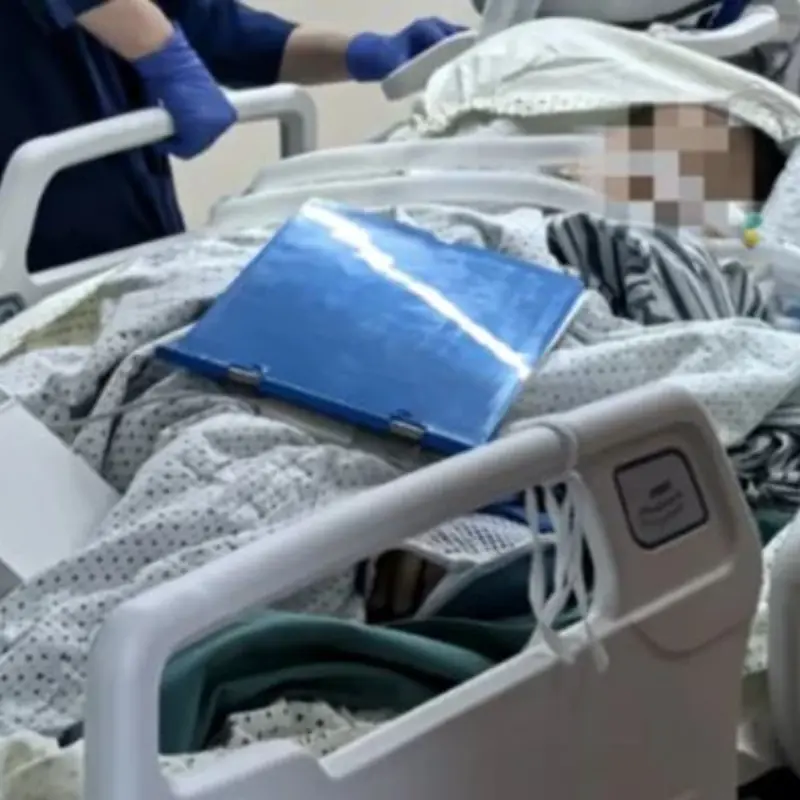 A 40-Year-Old Woman Was Rushed to the Hospital After Eating Grapefruit This Way