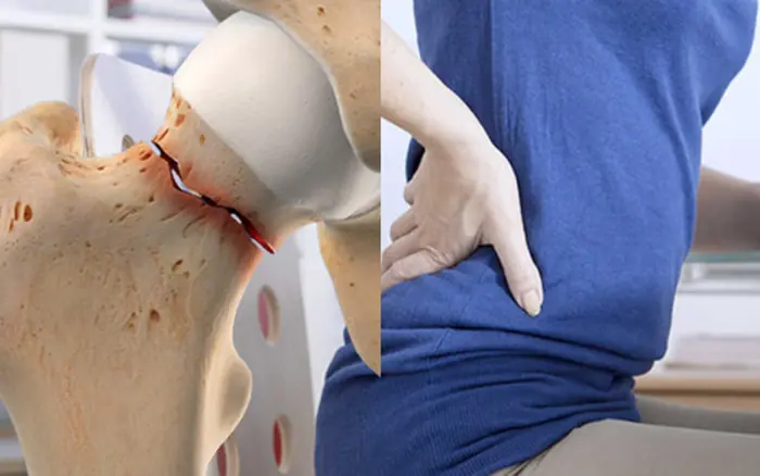 Postmenopausal Women Can Hardly Avoid Osteoporosis