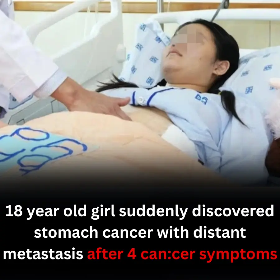 18 year old girl suddenly discovered stomach cancer with distant metastasis after 4 can.cer symptoms