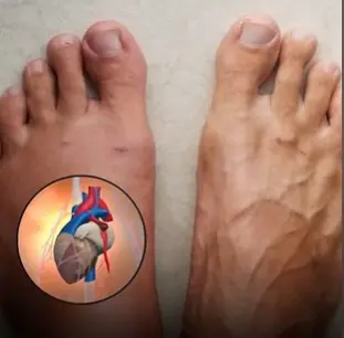 One Month Before A Heart Attack, Your Body Will Warn You Of These 7 Signs
