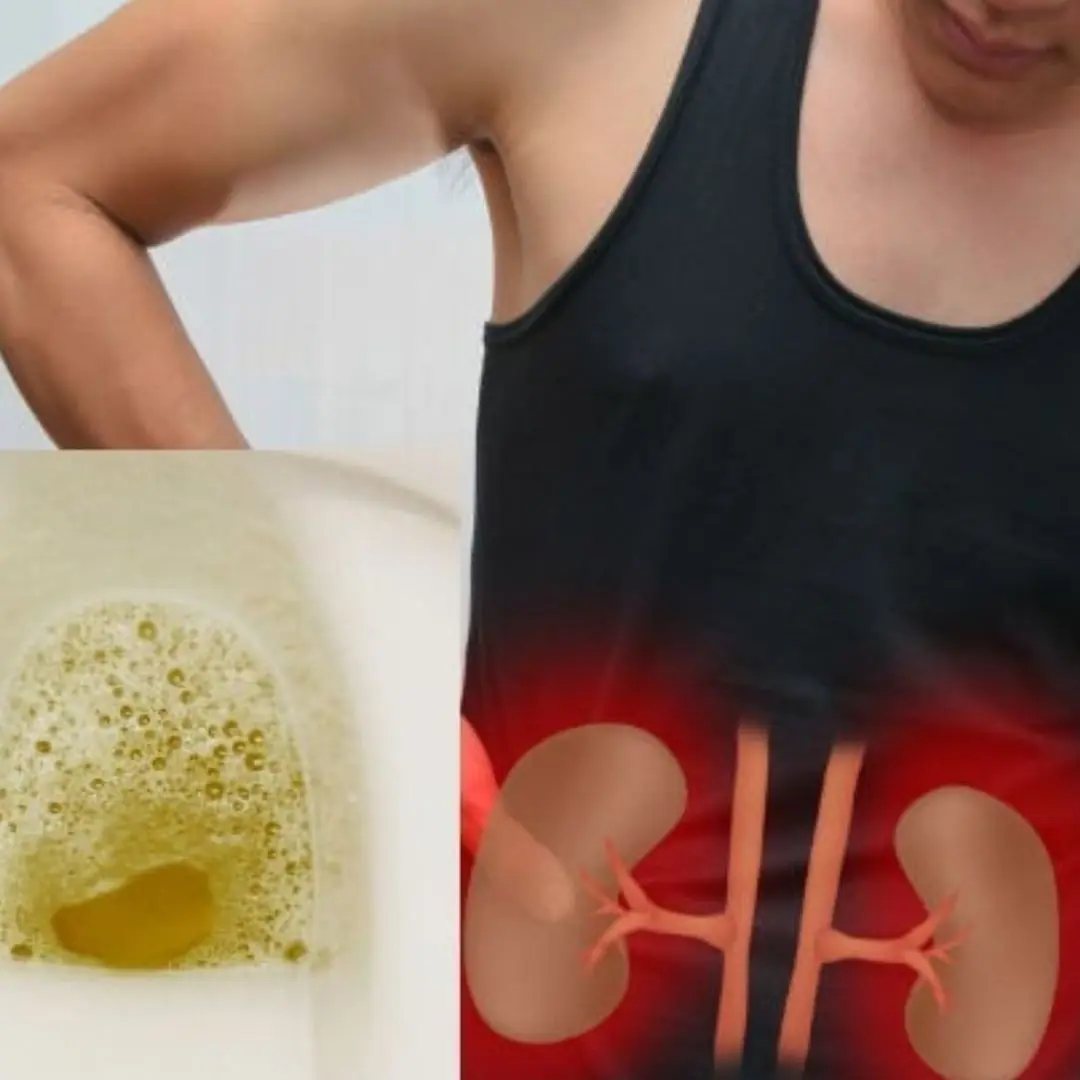 Waking up with foamy urine: Warning of 3 serious illnesses, number 1: Go to the hospital quickly
