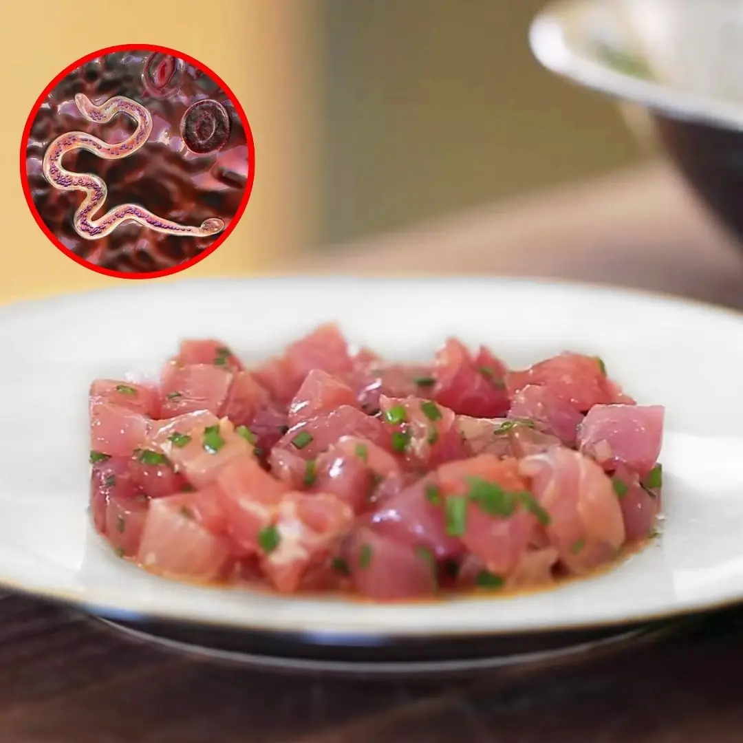 5 familiar foods are "hosts of parasites", eating them raw is like inviting disease into your body