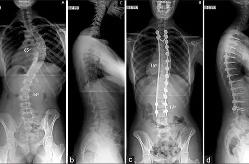 Sleeping in These 4 Positions Will Soon “Des.troy” Your Spine