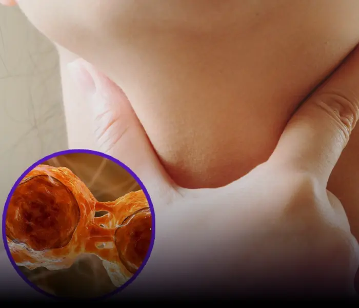 Lym.phoma survivors share six symptoms they experienced before diagnosis