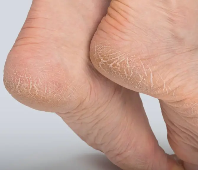 Pharmacist warns: Heel pa.in could signal a serious health issue!