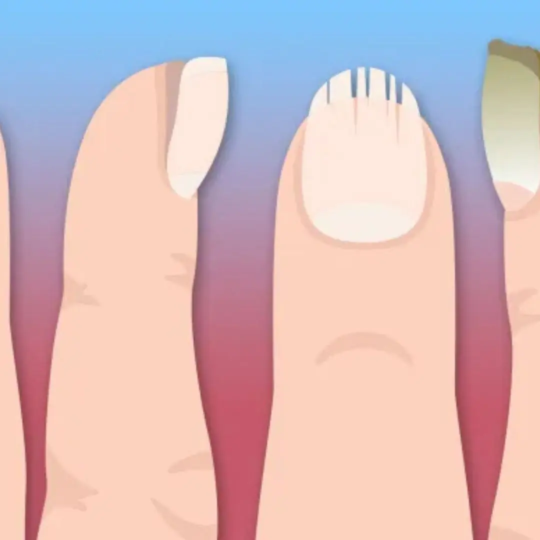 The 5 ‘silent’ can:cer signs you might miss on your nails