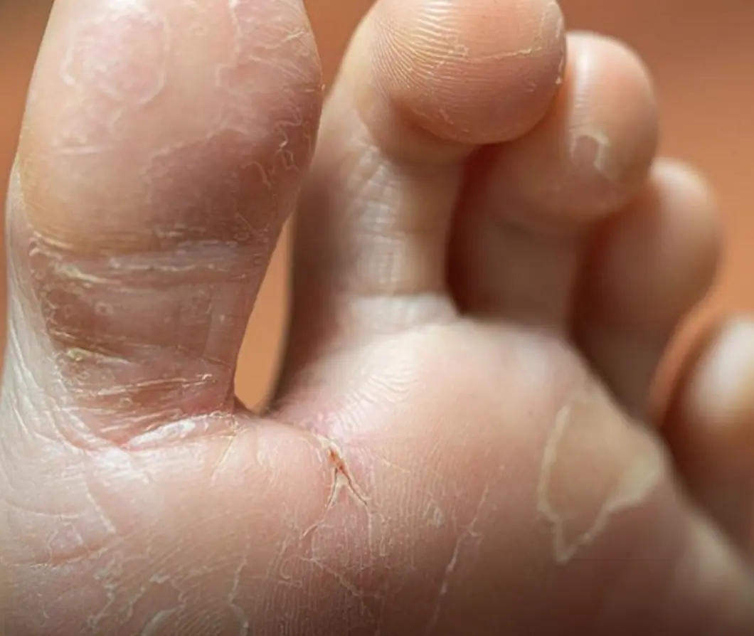7 subtle symptoms that could signal serious health problems