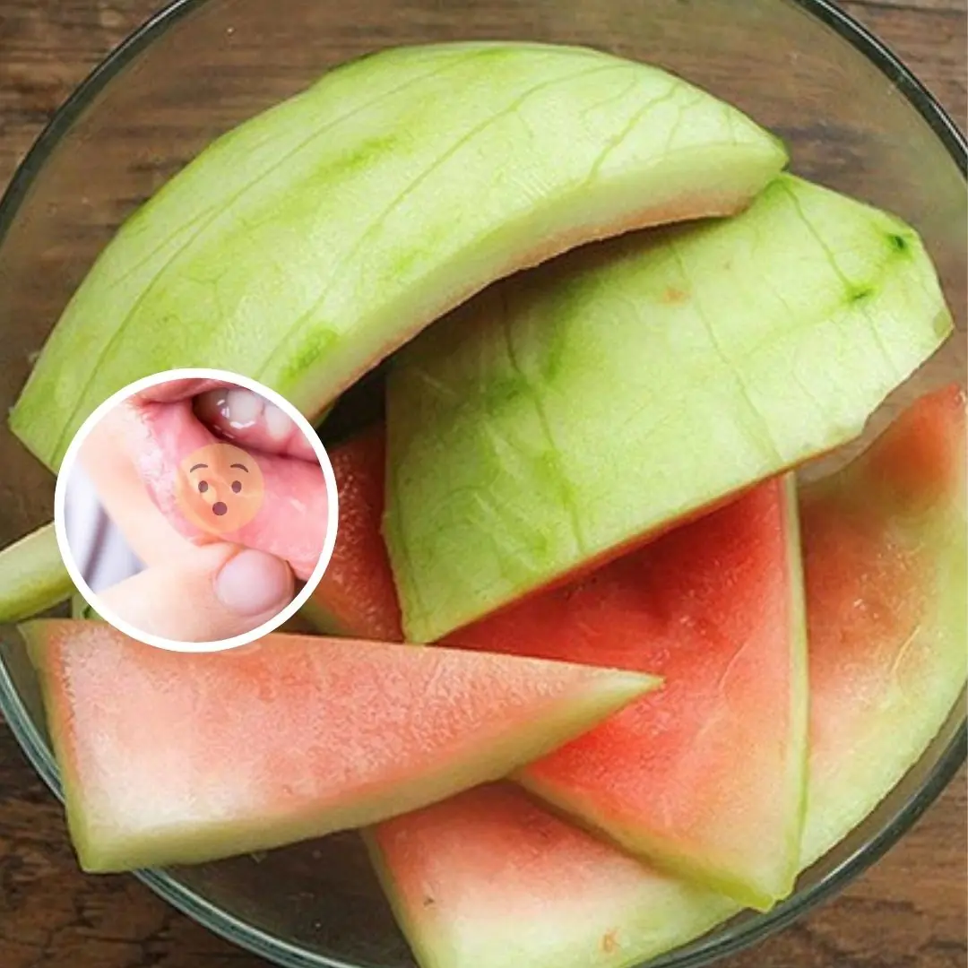 99% of people will throw away these 6 fruit peels when eating, but will regret it when they know their benefits
