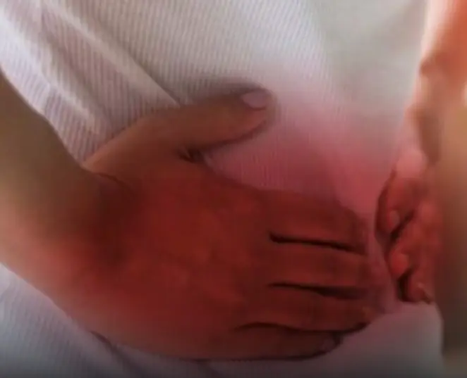 Umbilical Hernia: Causes, Symptoms and Treatment