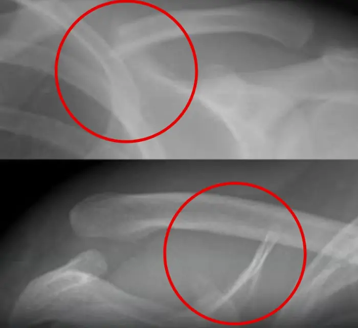 This poi.son des.troys your bones, but you drink it everyday